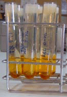 Quilomicrones donde se ve la fase blanquecina de la capa superior.